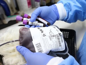 consenso informato trasfusione modulo
